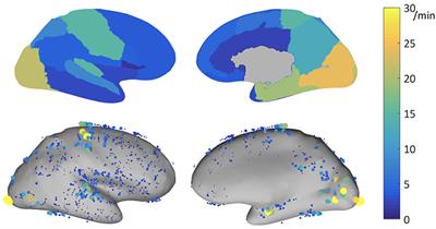 Localization of the Epileptogenic Zone Using High Frequency Oscillations